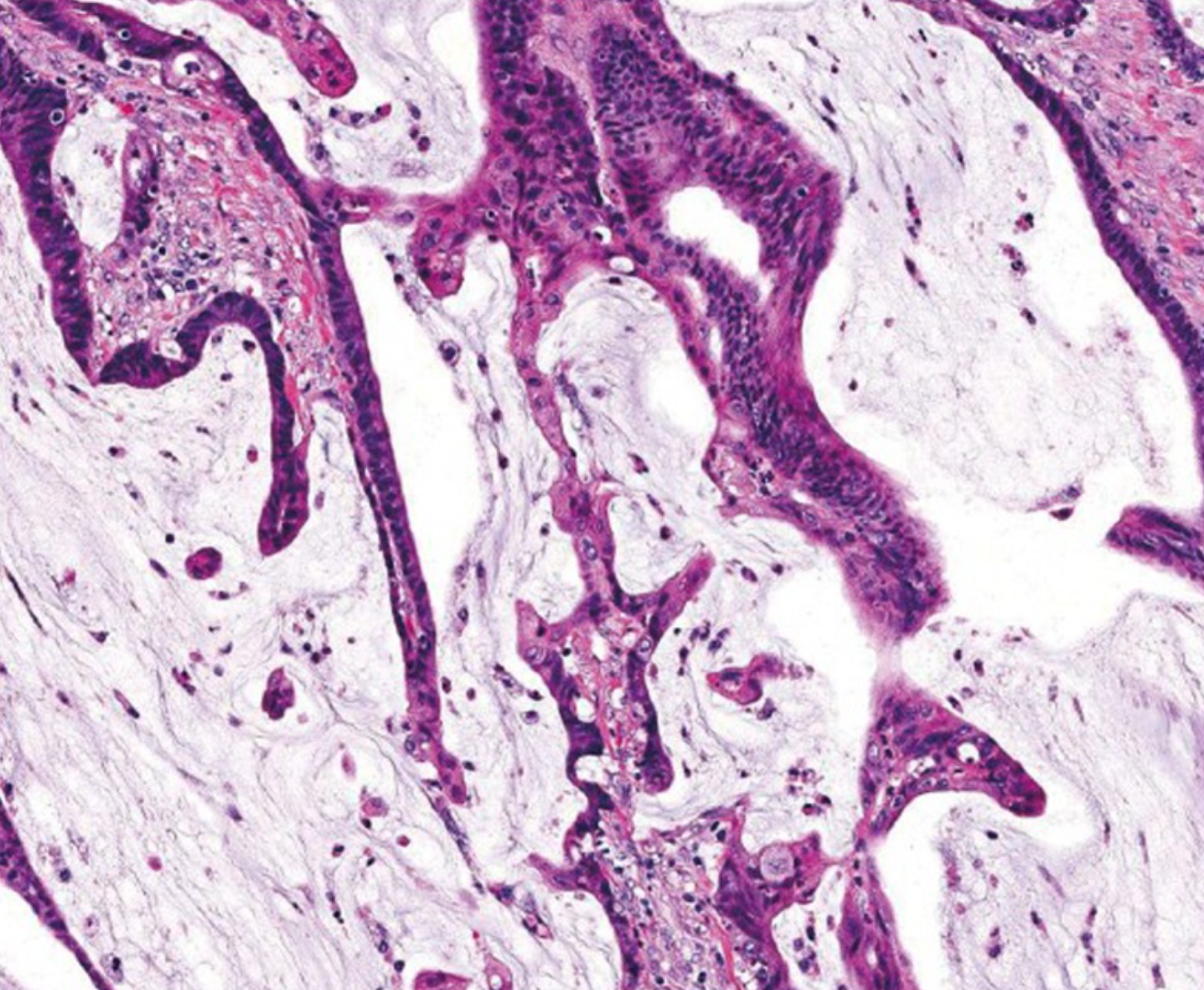 若本图无法展示,请更换浏览器查看